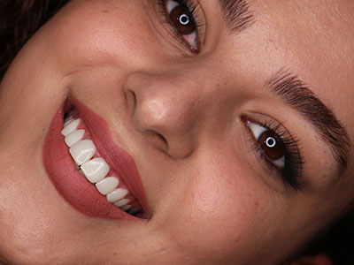 کامپوزیت ونیر