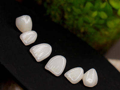 لمینیت سرامیکی