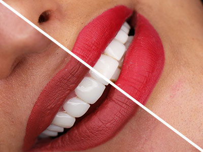 لمینیت و کامپوزیت