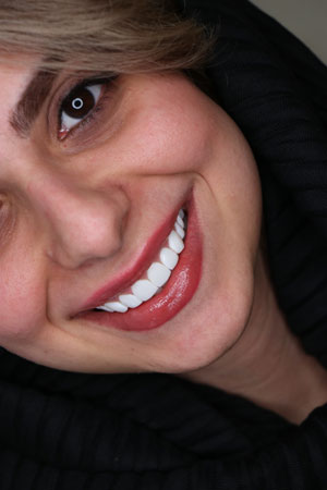 کامپوزیت ونییر